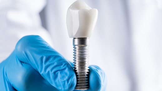 the benefits and considerations of same-day dental implants for seniors